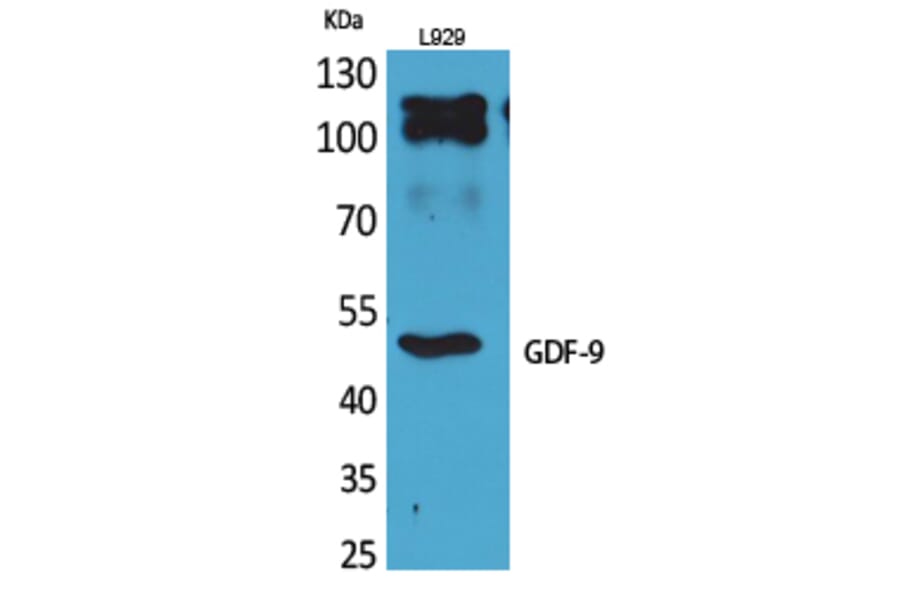 Western blot - GDF-9 Polyclonal Antibody from Signalway Antibody (41706) - Antibodies.com