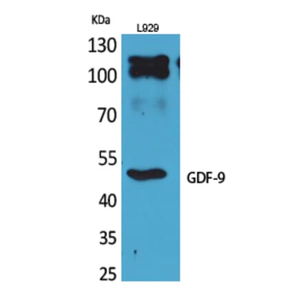 Western blot - GDF-9 Polyclonal Antibody from Signalway Antibody (41706) - Antibodies.com