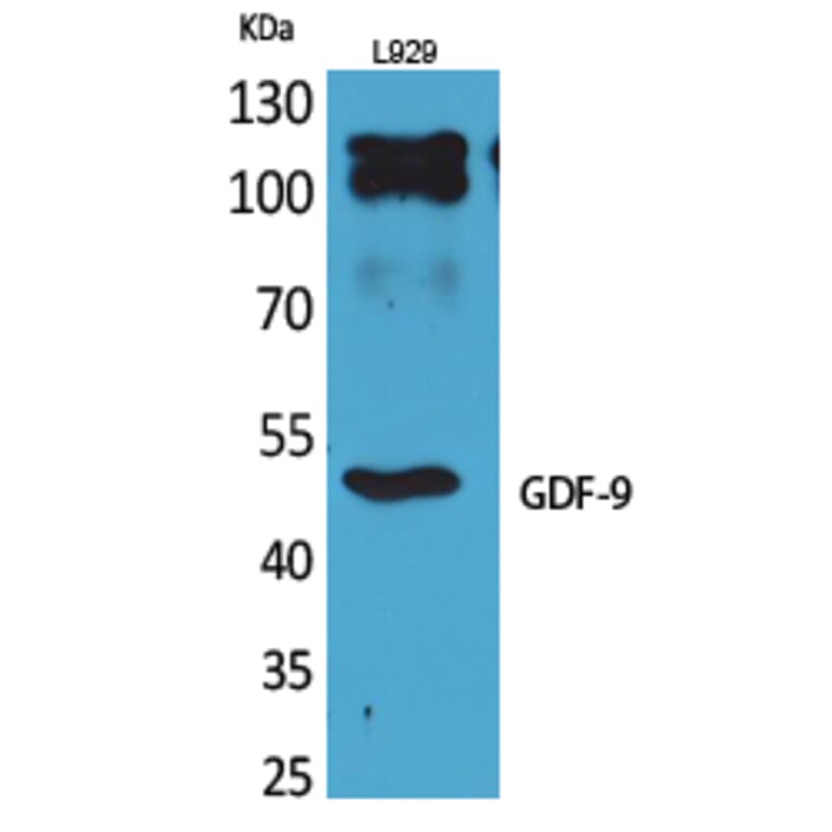 Western blot - GDF-9 Polyclonal Antibody from Signalway Antibody (41706) - Antibodies.com