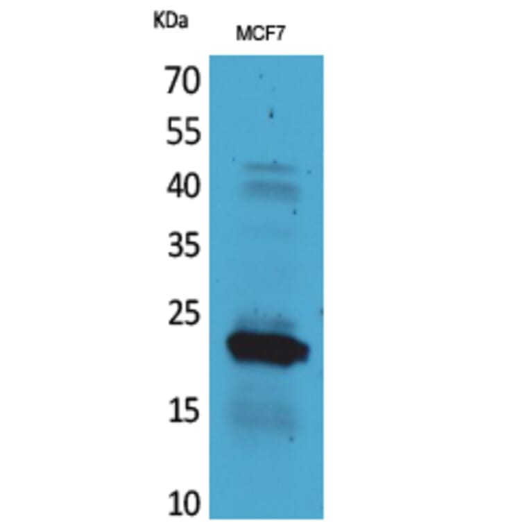 Western blot - IL-28 Polyclonal Antibody from Signalway Antibody (41707) - Antibodies.com