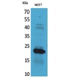 Western blot - IL-28 Polyclonal Antibody from Signalway Antibody (41707) - Antibodies.com