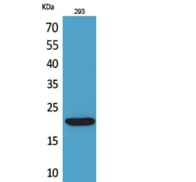 Western blot - CMTM6 Polyclonal Antibody from Signalway Antibody (41710) - Antibodies.com