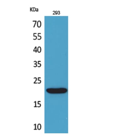 Western blot - CMTM6 Polyclonal Antibody from Signalway Antibody (41710) - Antibodies.com