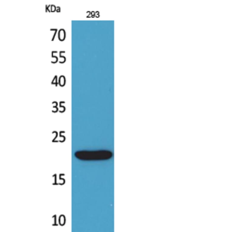 Western blot - CMTM6 Polyclonal Antibody from Signalway Antibody (41710) - Antibodies.com