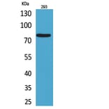 Western blot - Bcl-6 Polyclonal Antibody from Signalway Antibody (41713) - Antibodies.com