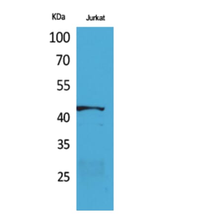 Western blot - E2F-4 Polyclonal Antibody from Signalway Antibody (41716) - Antibodies.com