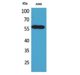 Western blot - ALDH2 Polyclonal Antibody from Signalway Antibody (41745) - Antibodies.com