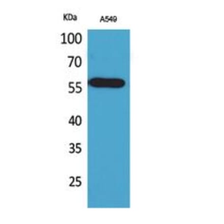 Western blot - ALDH2 Polyclonal Antibody from Signalway Antibody (41745) - Antibodies.com