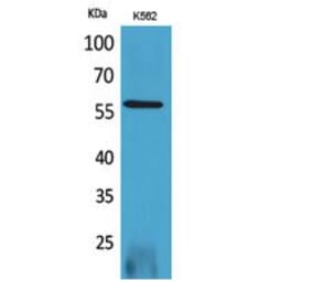 Western blot - RUNX2 Polyclonal Antibody from Signalway Antibody (41746) - Antibodies.com