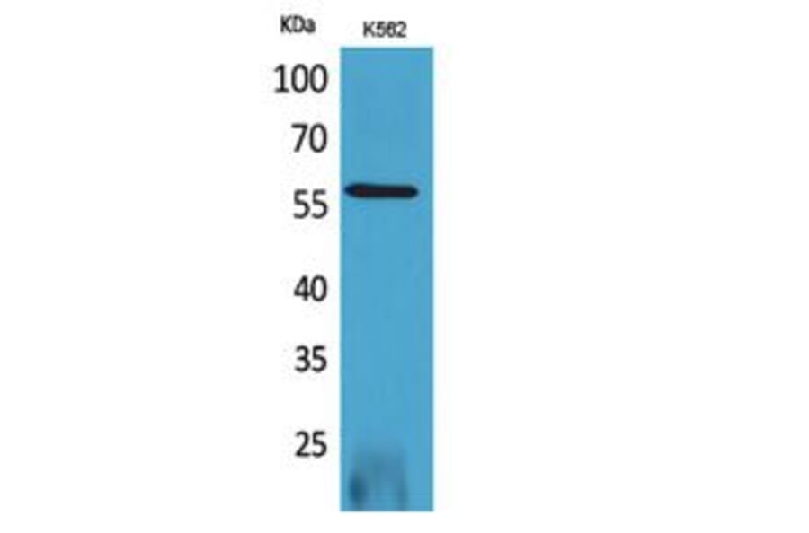 Western blot - RUNX2 Polyclonal Antibody from Signalway Antibody (41746) - Antibodies.com