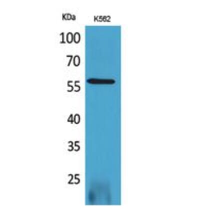 Western blot - RUNX2 Polyclonal Antibody from Signalway Antibody (41746) - Antibodies.com