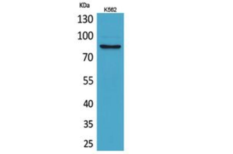 Western blot - MMP-9 Polyclonal Antibody from Signalway Antibody (41747) - Antibodies.com