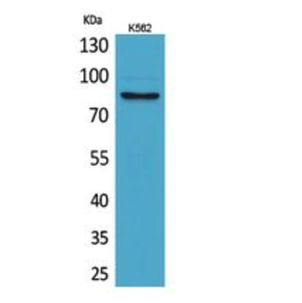 Western blot - MMP-9 Polyclonal Antibody from Signalway Antibody (41747) - Antibodies.com