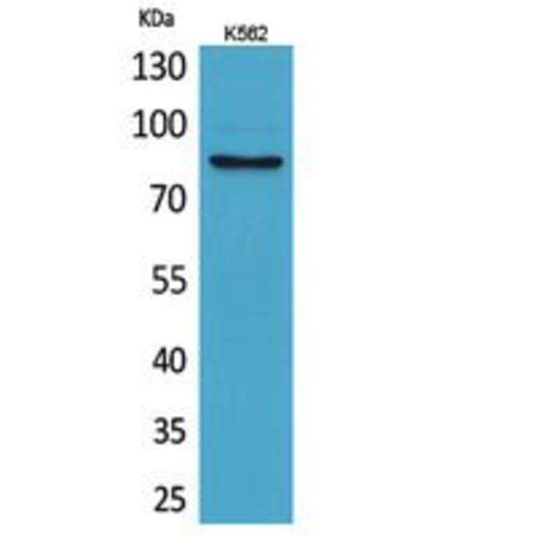 Western blot - MMP-9 Polyclonal Antibody from Signalway Antibody (41747) - Antibodies.com