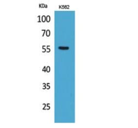 Western blot - Glut5 Polyclonal Antibody from Signalway Antibody (41774) - Antibodies.com