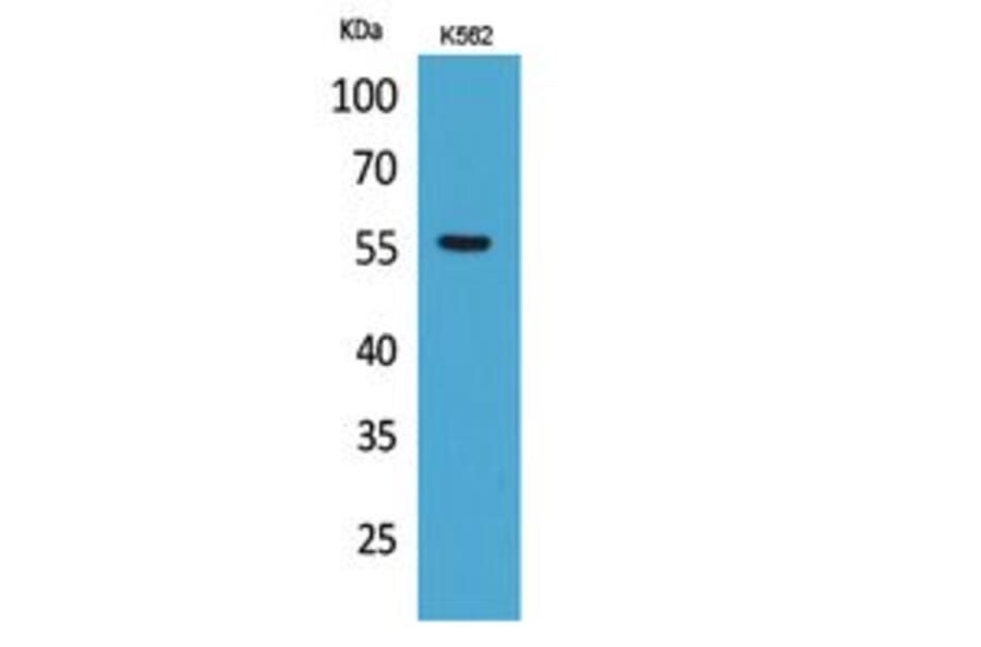 Western blot - Glut5 Polyclonal Antibody from Signalway Antibody (41774) - Antibodies.com