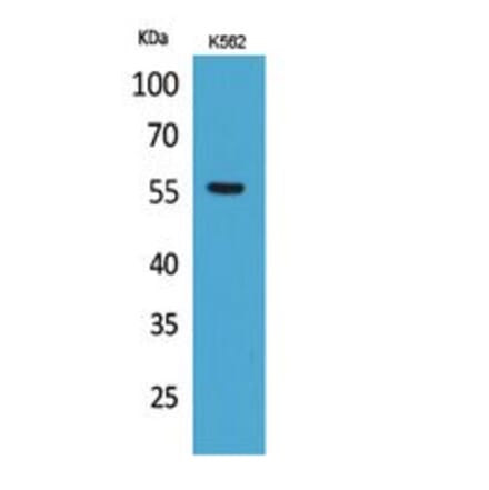 Western blot - Glut5 Polyclonal Antibody from Signalway Antibody (41774) - Antibodies.com