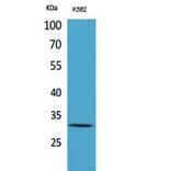 Western blot - VDAC1 Polyclonal Antibody from Signalway Antibody (41776) - Antibodies.com