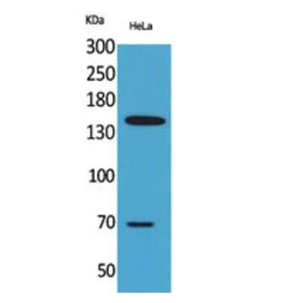 Western blot - CD42b Polyclonal Antibody from Signalway Antibody (41778) - Antibodies.com