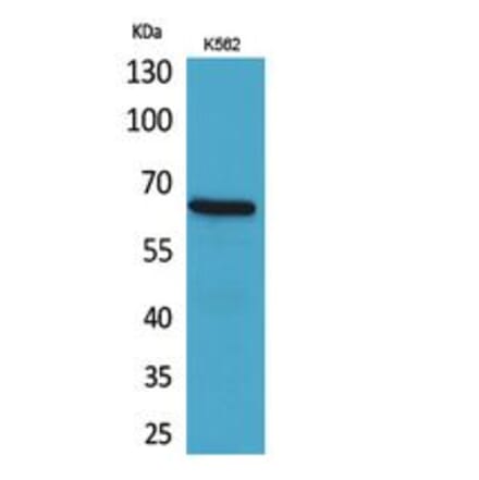 Western blot - CD166 Polyclonal Antibody from Signalway Antibody (41781) - Antibodies.com