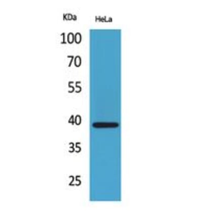 Western blot - Bonzo Polyclonal Antibody from Signalway Antibody (41783) - Antibodies.com