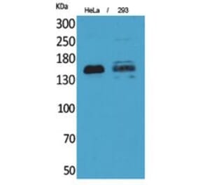 Western blot - CD148 Polyclonal Antibody from Signalway Antibody (41785) - Antibodies.com