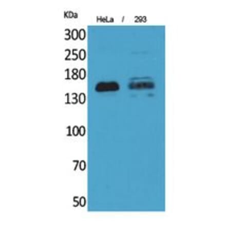 Western blot - CD148 Polyclonal Antibody from Signalway Antibody (41785) - Antibodies.com