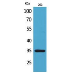 Western blot - RANKL Polyclonal Antibody from Signalway Antibody (41789) - Antibodies.com
