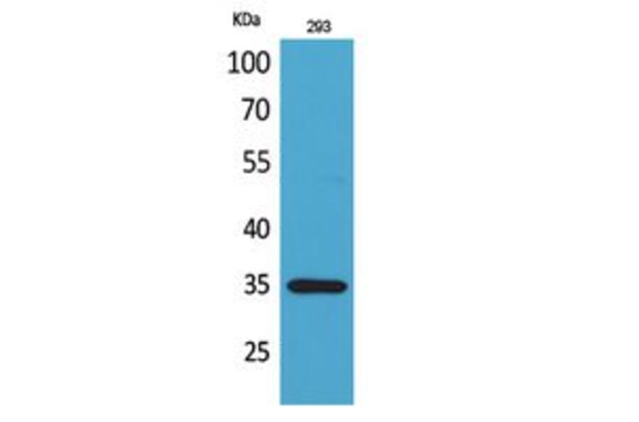 Western blot - RANKL Polyclonal Antibody from Signalway Antibody (41789) - Antibodies.com