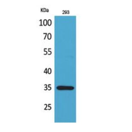 Western blot - RANKL Polyclonal Antibody from Signalway Antibody (41789) - Antibodies.com