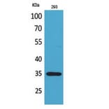 Western blot - RANKL Polyclonal Antibody from Signalway Antibody (41789) - Antibodies.com