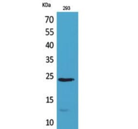 Western blot - MDA-7 Polyclonal Antibody from Signalway Antibody (41796) - Antibodies.com