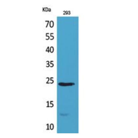 Western blot - MDA-7 Polyclonal Antibody from Signalway Antibody (41796) - Antibodies.com