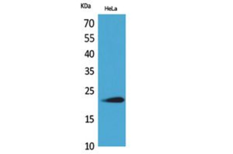 Western blot - IFN-ω Polyclonal Antibody from Signalway Antibody (41800) - Antibodies.com
