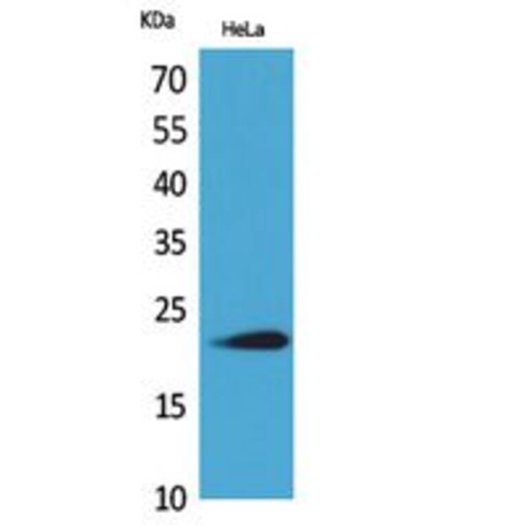 Western blot - IFN-ω Polyclonal Antibody from Signalway Antibody (41800) - Antibodies.com