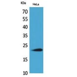 Western blot - IFN-ω Polyclonal Antibody from Signalway Antibody (41800) - Antibodies.com
