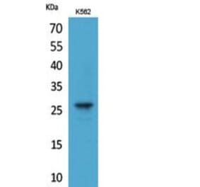 Western blot - FGF-8 Polyclonal Antibody from Signalway Antibody (41815) - Antibodies.com
