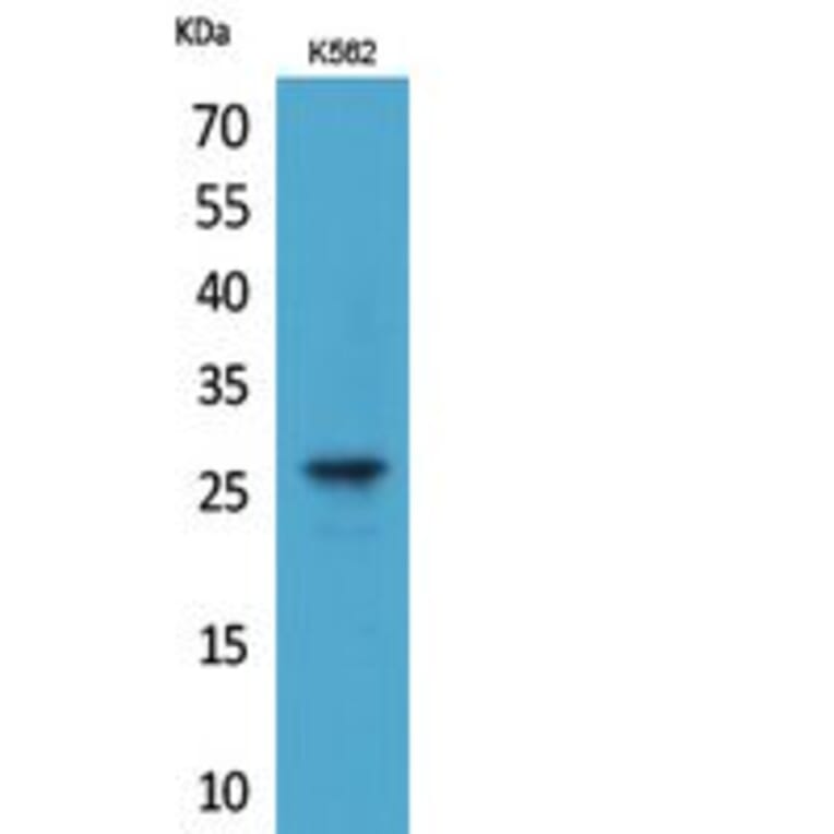 Western blot - FGF-8 Polyclonal Antibody from Signalway Antibody (41815) - Antibodies.com