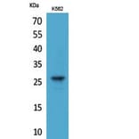 Western blot - FGF-8 Polyclonal Antibody from Signalway Antibody (41815) - Antibodies.com