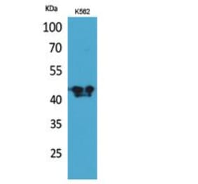 Western blot - ECA39 Polyclonal Antibody from Signalway Antibody (41820) - Antibodies.com