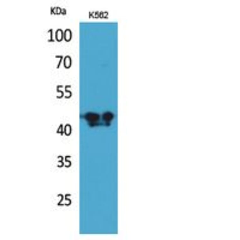 Western blot - ECA39 Polyclonal Antibody from Signalway Antibody (41820) - Antibodies.com