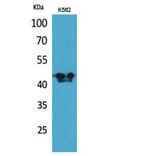 Western blot - ECA39 Polyclonal Antibody from Signalway Antibody (41820) - Antibodies.com