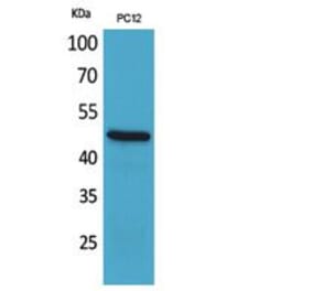 Western blot - FOXP3 Polyclonal Antibody from Signalway Antibody (41822) - Antibodies.com