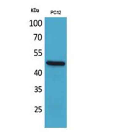 Western blot - FOXP3 Polyclonal Antibody from Signalway Antibody (41822) - Antibodies.com