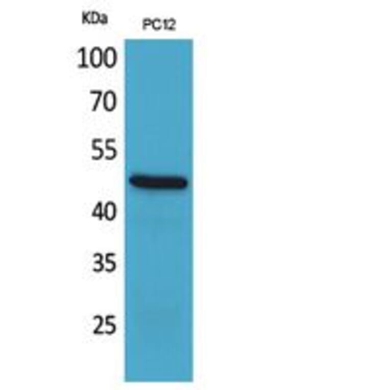 Western blot - FOXP3 Polyclonal Antibody from Signalway Antibody (41822) - Antibodies.com