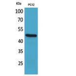 Western blot - FOXP3 Polyclonal Antibody from Signalway Antibody (41822) - Antibodies.com