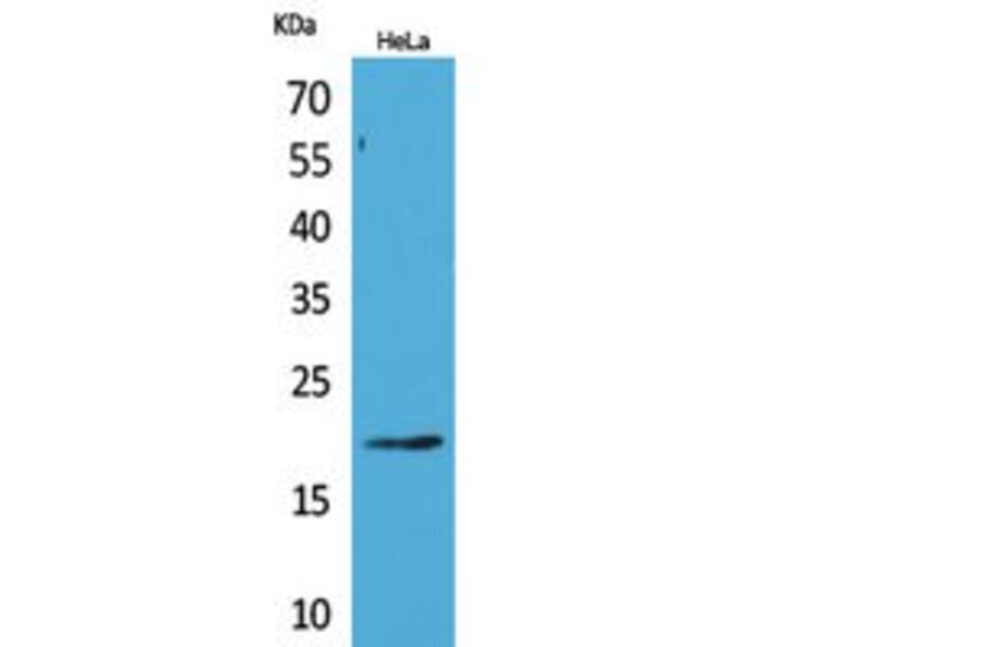 Western blot - CD3-δ Polyclonal Antibody from Signalway Antibody (41831) - Antibodies.com
