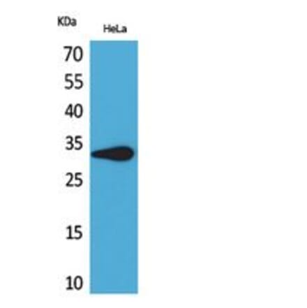 Western blot - CD85f Polyclonal Antibody from Signalway Antibody (41837) - Antibodies.com