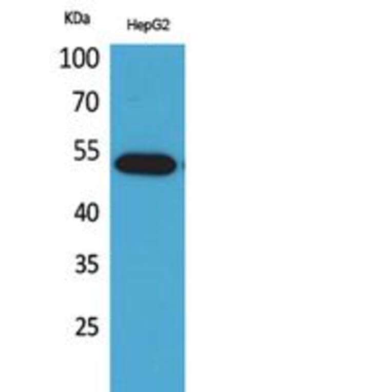 Western blot - LIR-7 Polyclonal Antibody from Signalway Antibody (41838) - Antibodies.com
