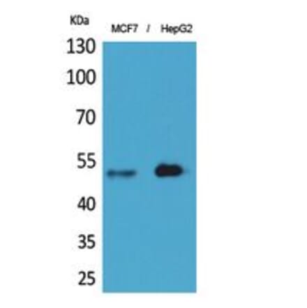 Western blot - LIR-6 Polyclonal Antibody from Signalway Antibody (41839) - Antibodies.com